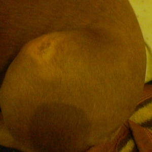 fungi(ringworm??)