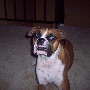 underbite!
