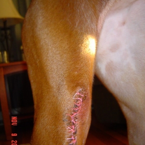 Madison's surgery