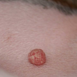 Strange Bump On His Chest 2