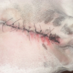 Abby's MCT removal