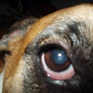 Zaynah's right eye