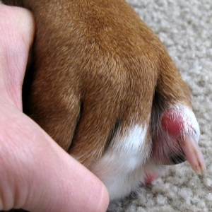 Sore toe