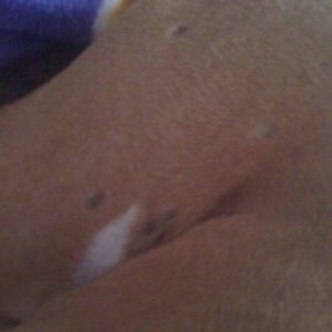 Skin Issues - Back of Right Leg