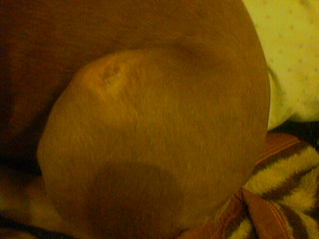 fungi(ringworm??)