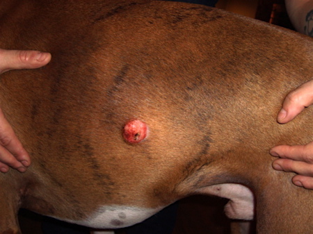 Jake's Ulcerated Histiocytoma