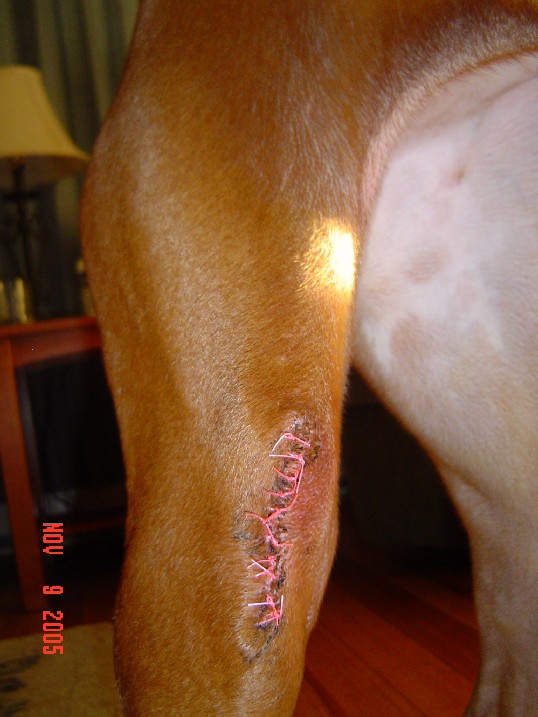 Madison's surgery