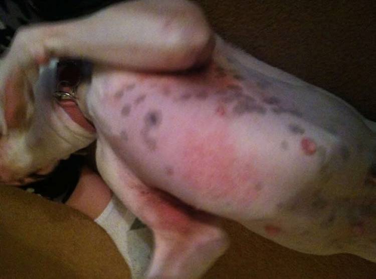 Skin irritation