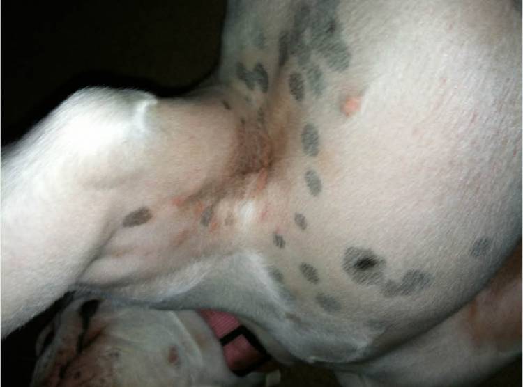 Skin irritation
