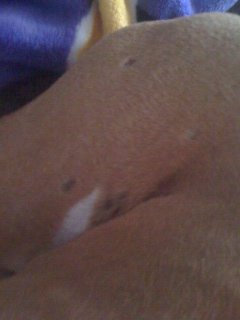 Skin Issues - Back of Right Leg