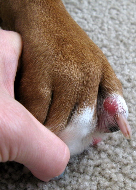 Sore toe