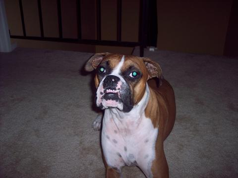 underbite!