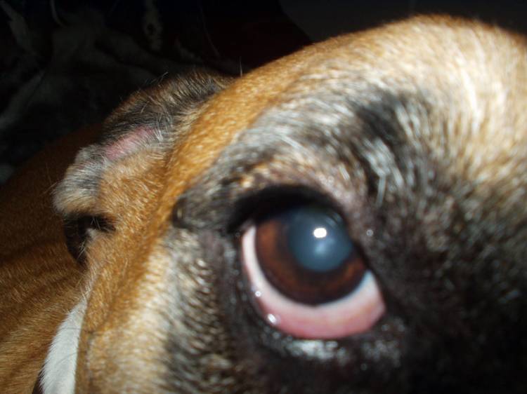 Zaynah's right eye